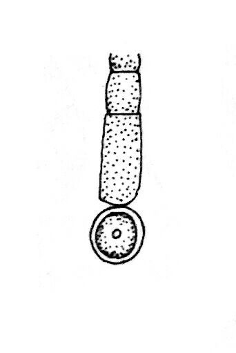 Fragmentation of Cylindrospermum